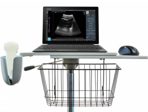 Ultrasound